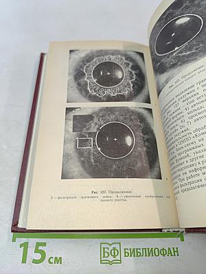 Клиническая иридология