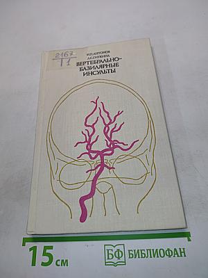Вертебрально-базилярные инсульты