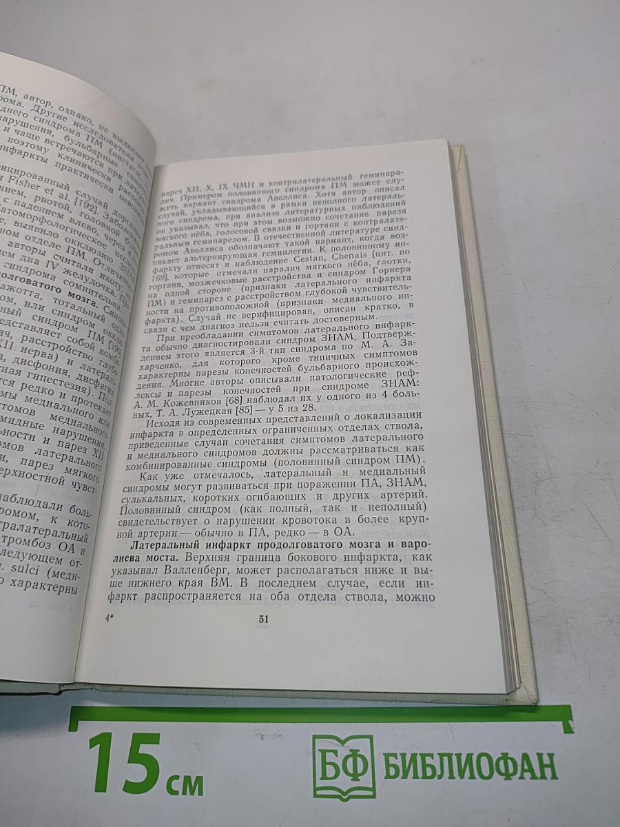 Вертебрально-базилярные инсульты