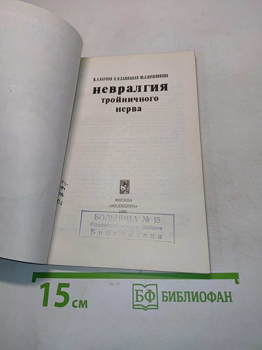 Невралгия тройничного нерва