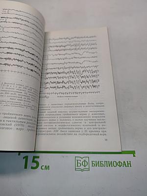 Невралгия тройничного нерва
