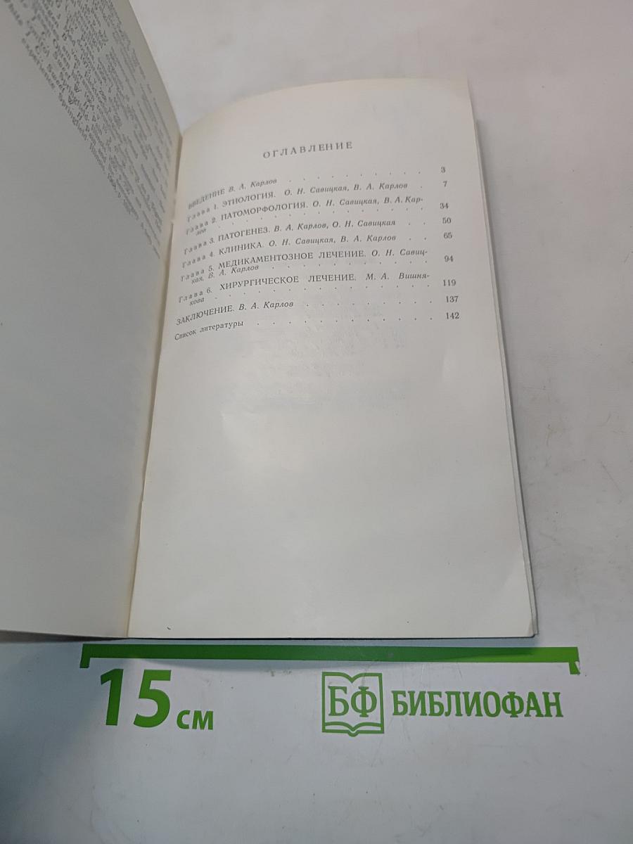 Невралгия тройничного нерва