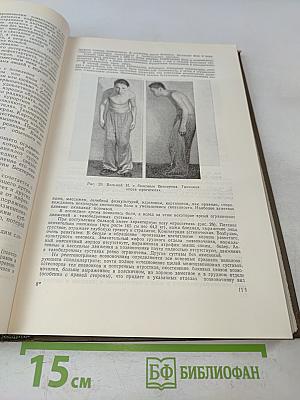 Клиника коллагеновых болезней