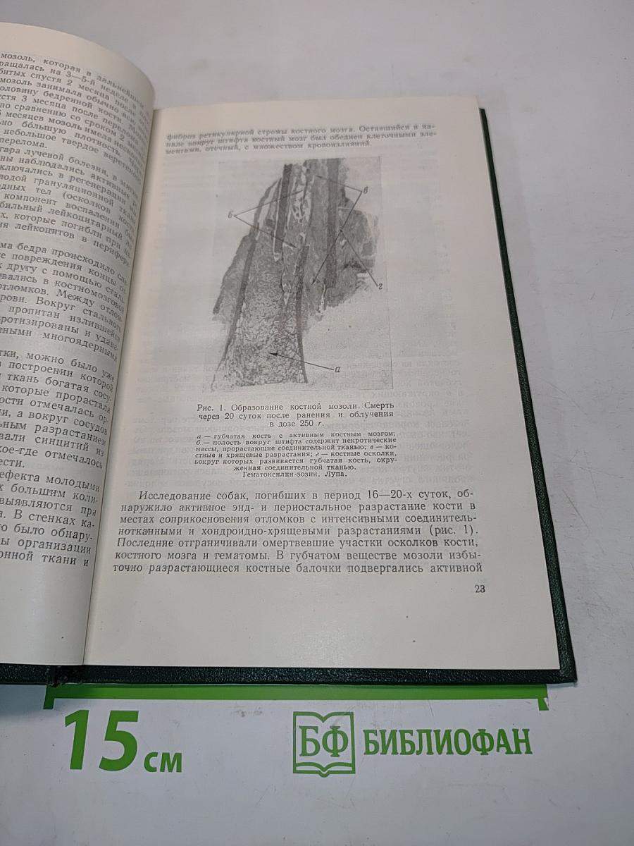 Восстановительные и компенсаторные процессы при лучевой болезни