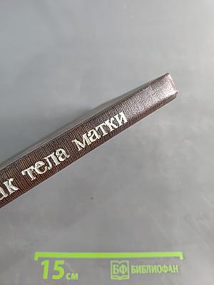 Рак тела матки