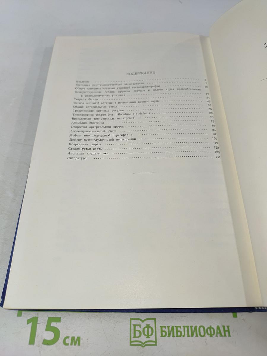 Рентгенологическое исследование при врожденных пороках сердца