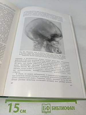 Рентгенодиагностика заболеваний костей и суставов