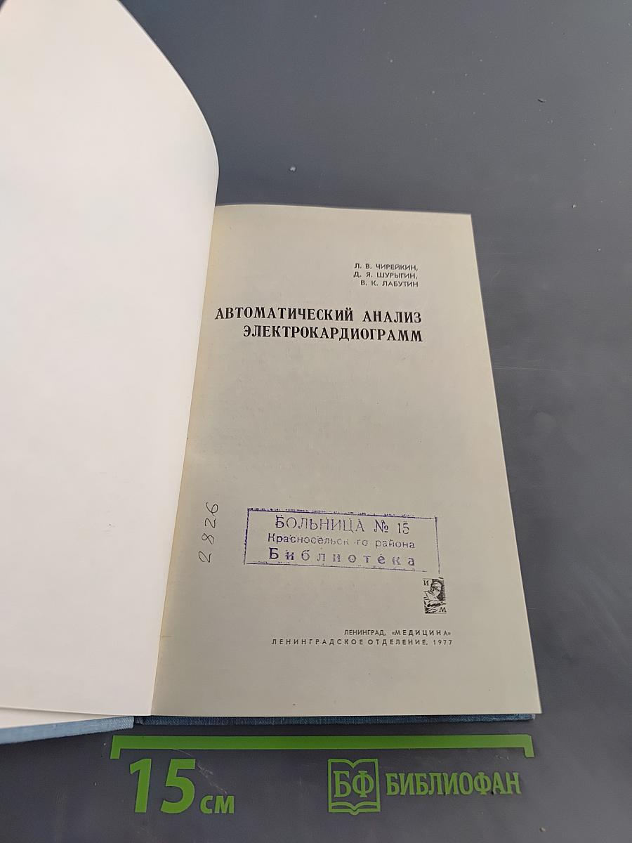 Автоматический анализ электрокардиограмм