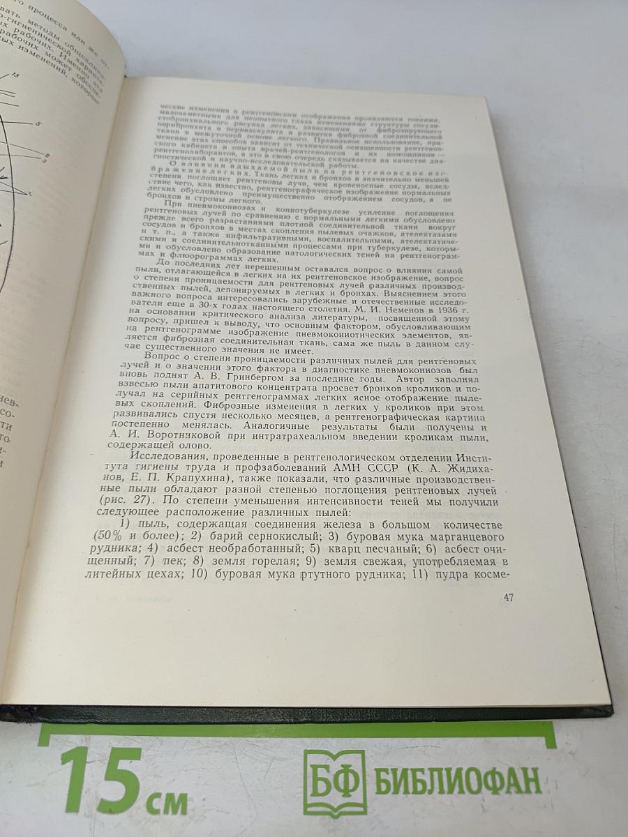 Рентгенология профессиональных заболеваний и интоксикаций