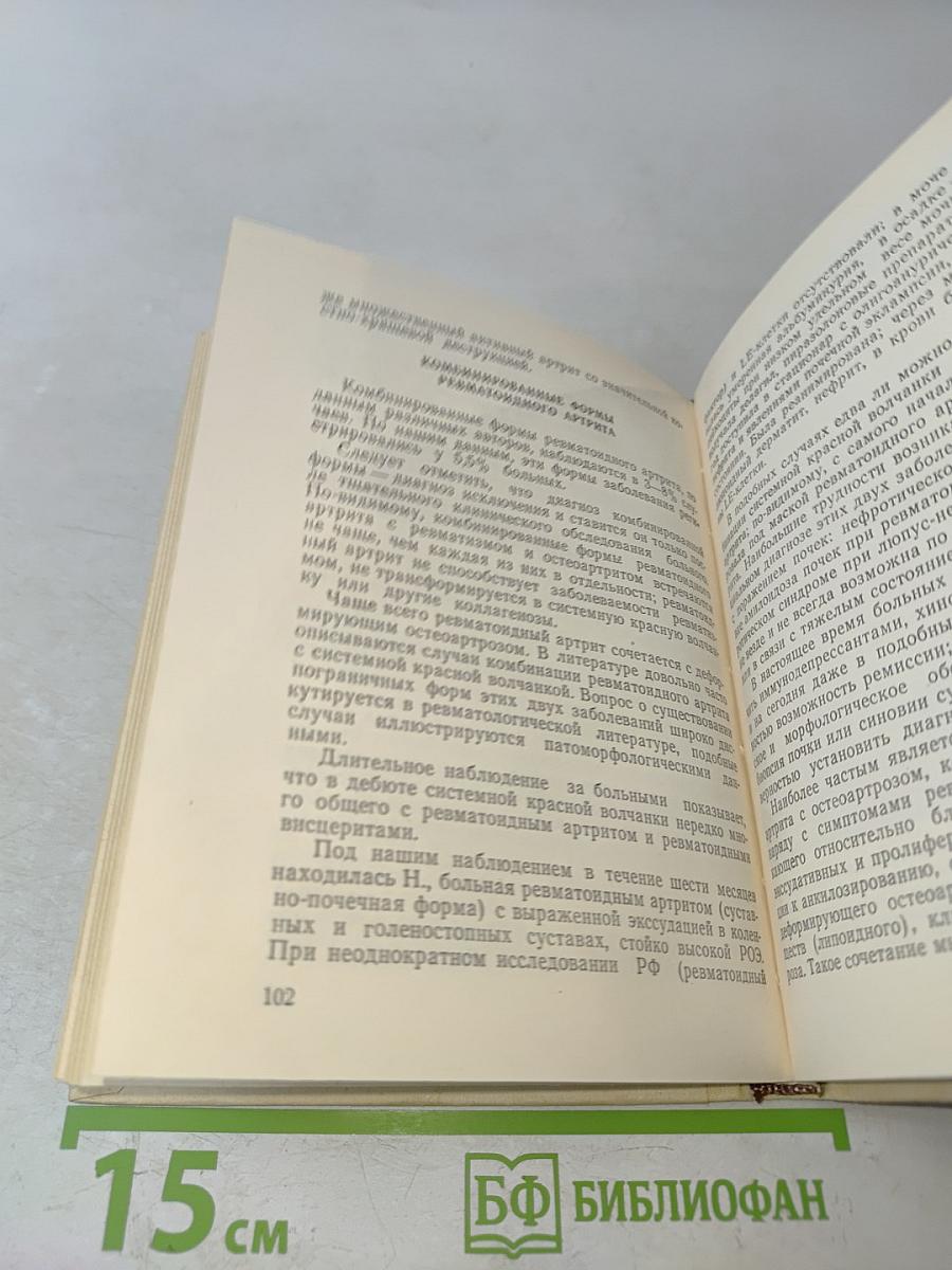 Ревматоидный артрит