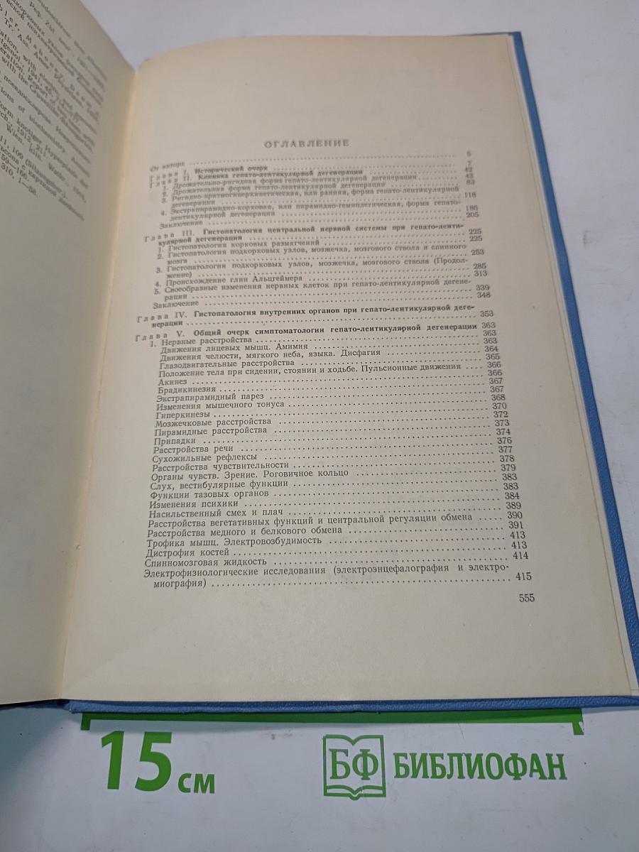 Гепато-церебральная дистрофия