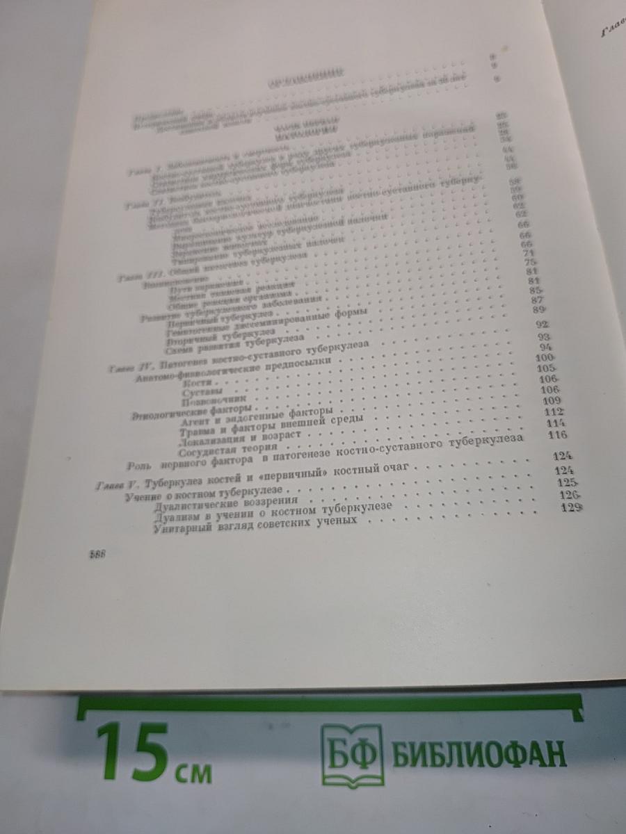 Костно-суставной туберкулез