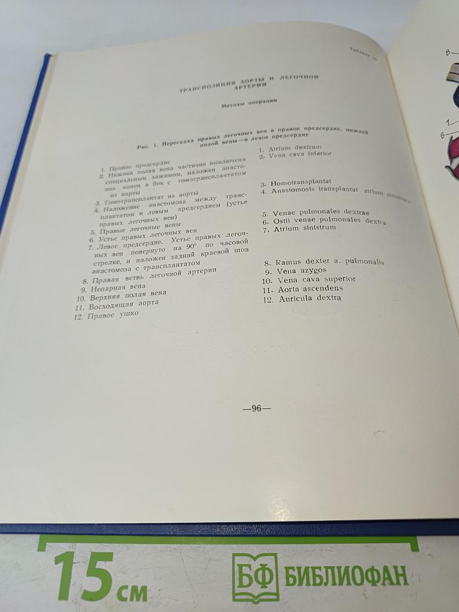 Атлас хирургии сердца