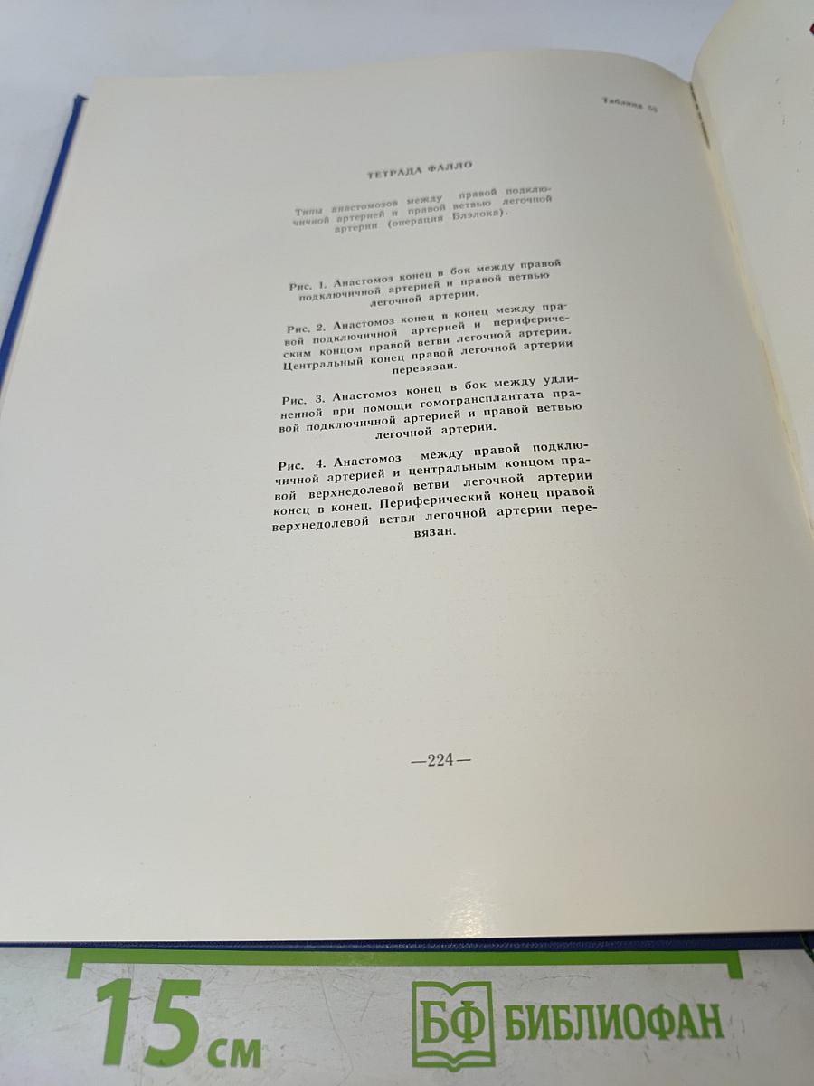 Атлас хирургии сердца