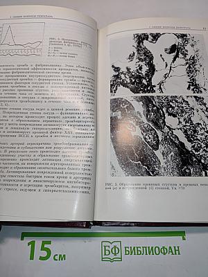 Актуальные проблемы гемостазиологии