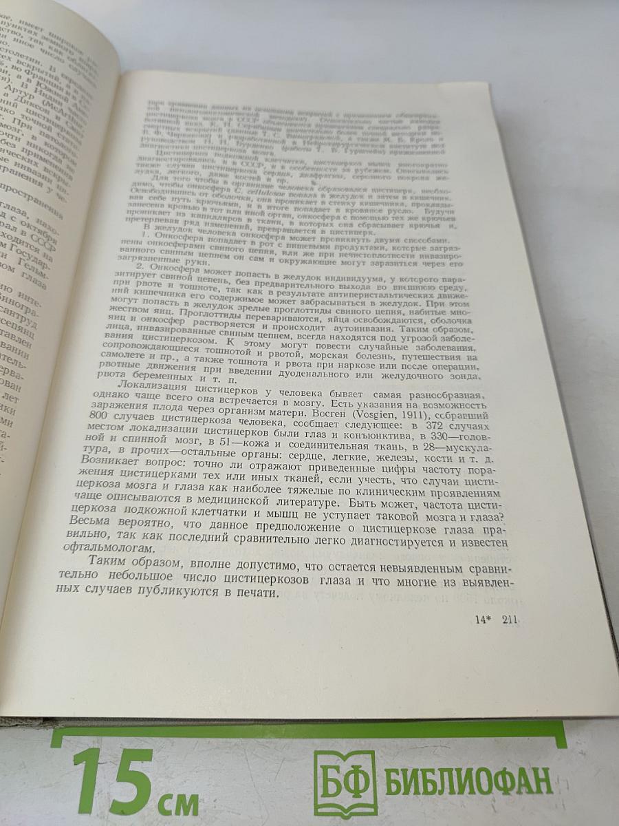 Глистные болезни человека