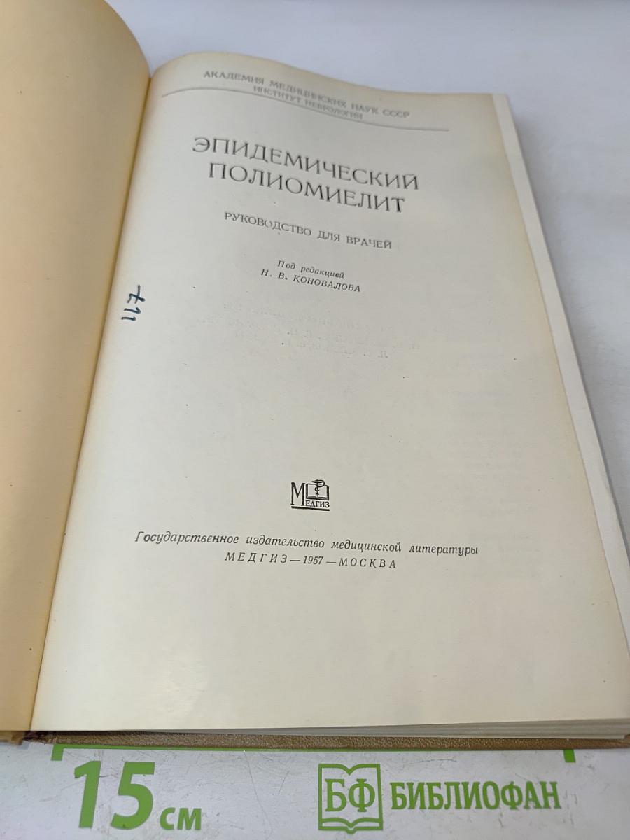 Эпидемический полиомиелит