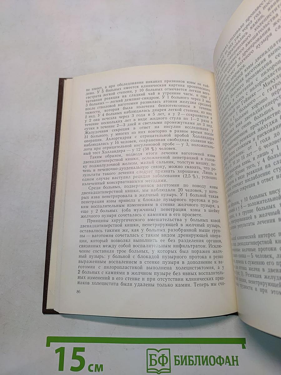 Лечение язвы двенадцатиперстной кишки ваготомией