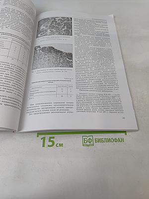 Вестник хирургии имени И.И. Грекова
