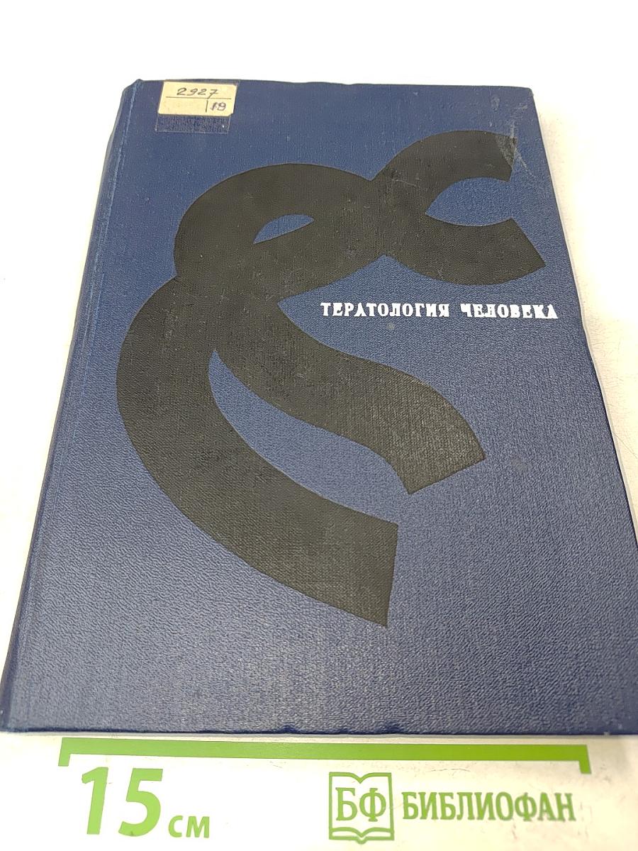 Тератология человека