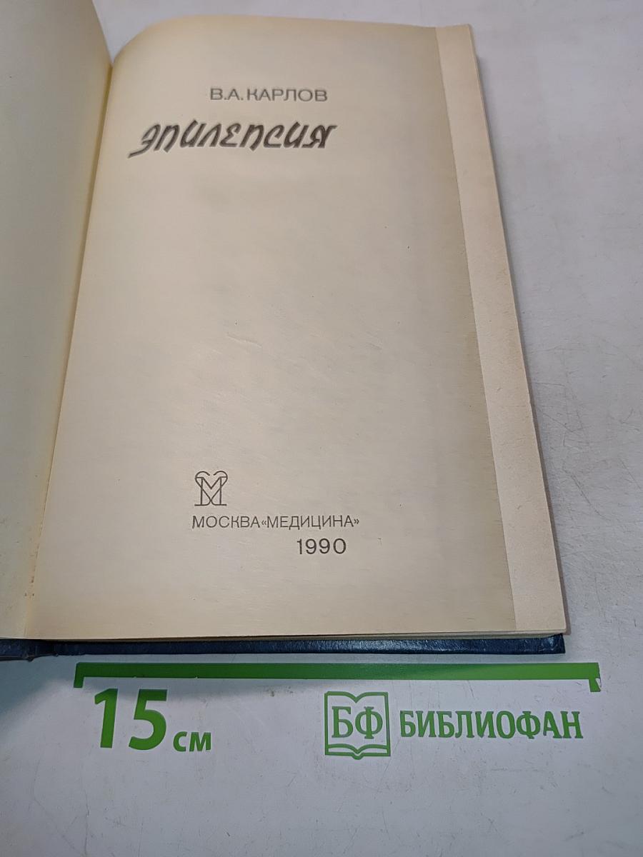 Эпилепсия