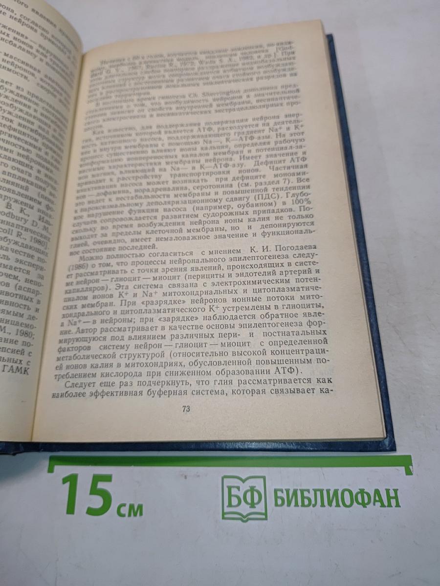 Эпилепсия
