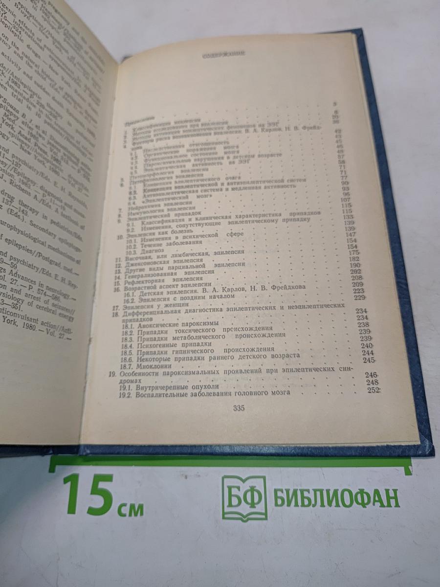 Эпилепсия