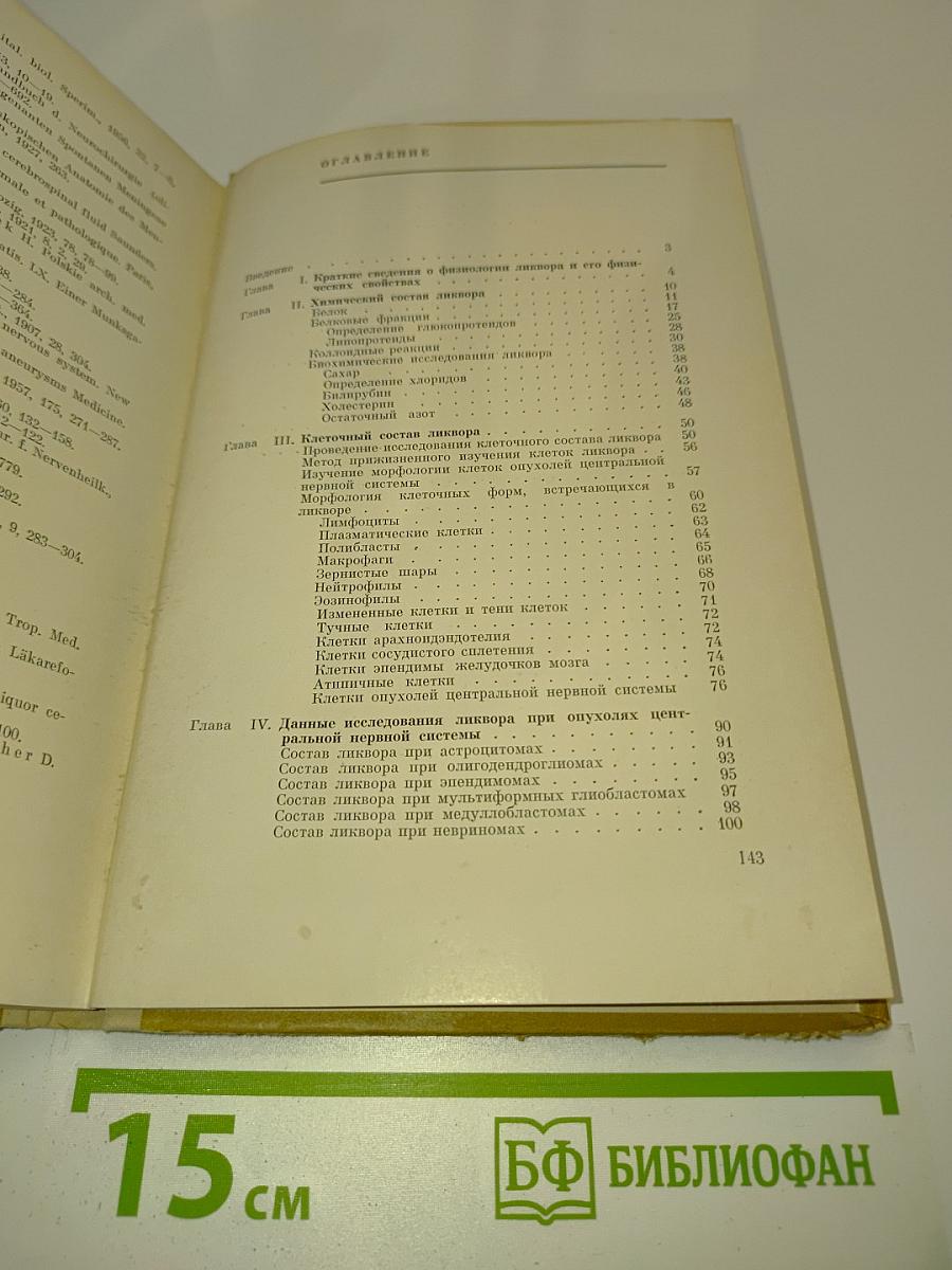 Исследование спинномозговой жидкости