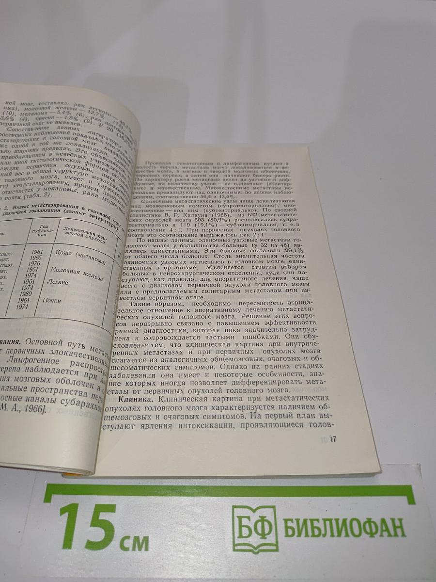 Метастатические опухоли