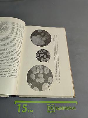 Бактерии группы сенной и картофельной палочек (Bac. subtilis и Bac. mesentericus)
