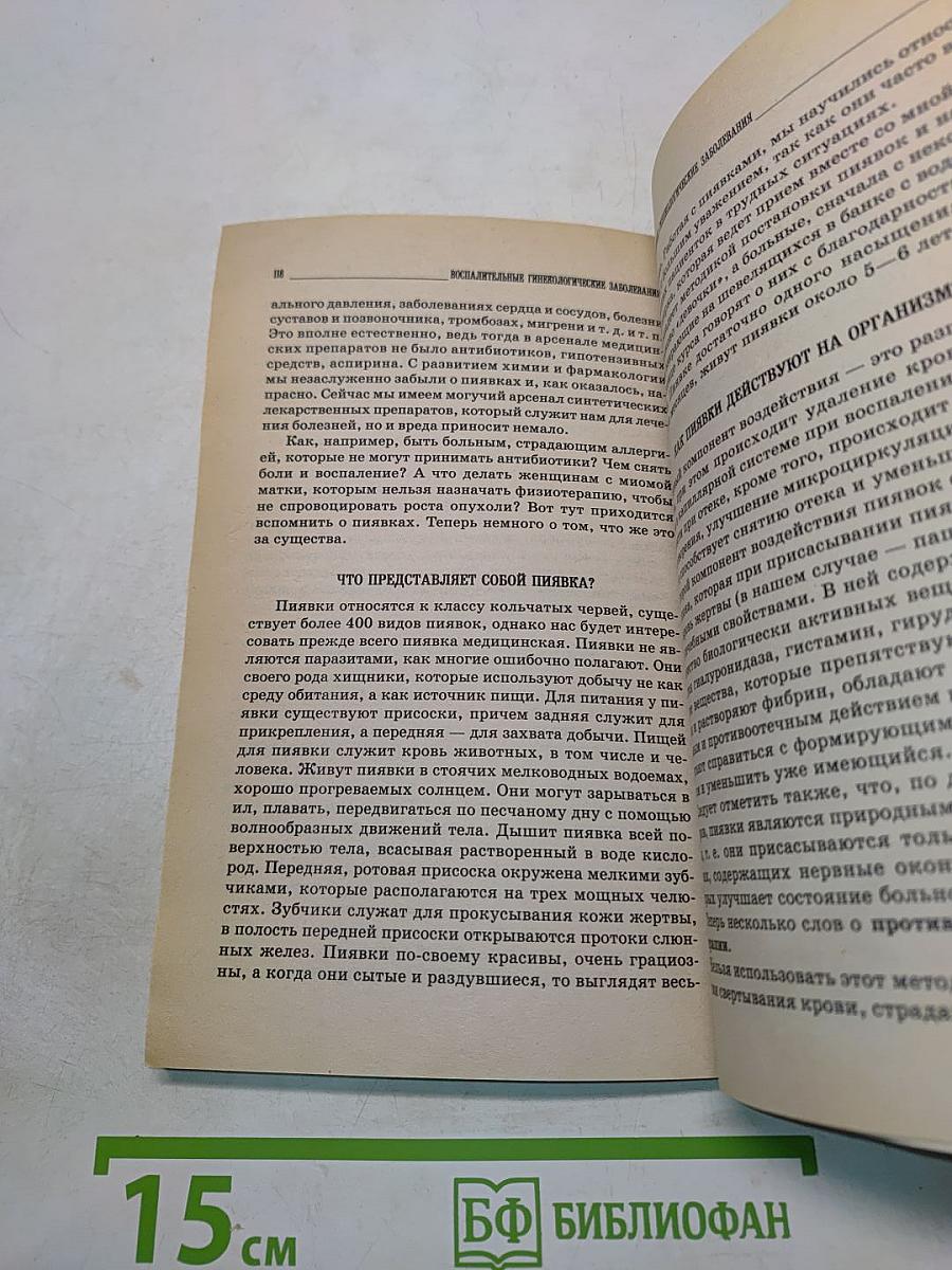 Воспалительные гинекологические заболевания: симптомы, профилактика, качественное лечение