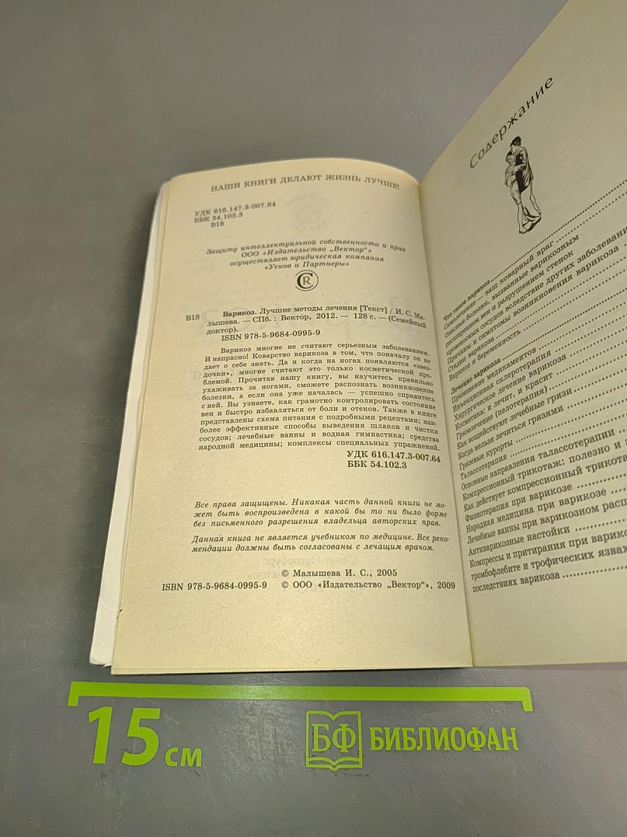 Варикоз. Лучшие методы лечения