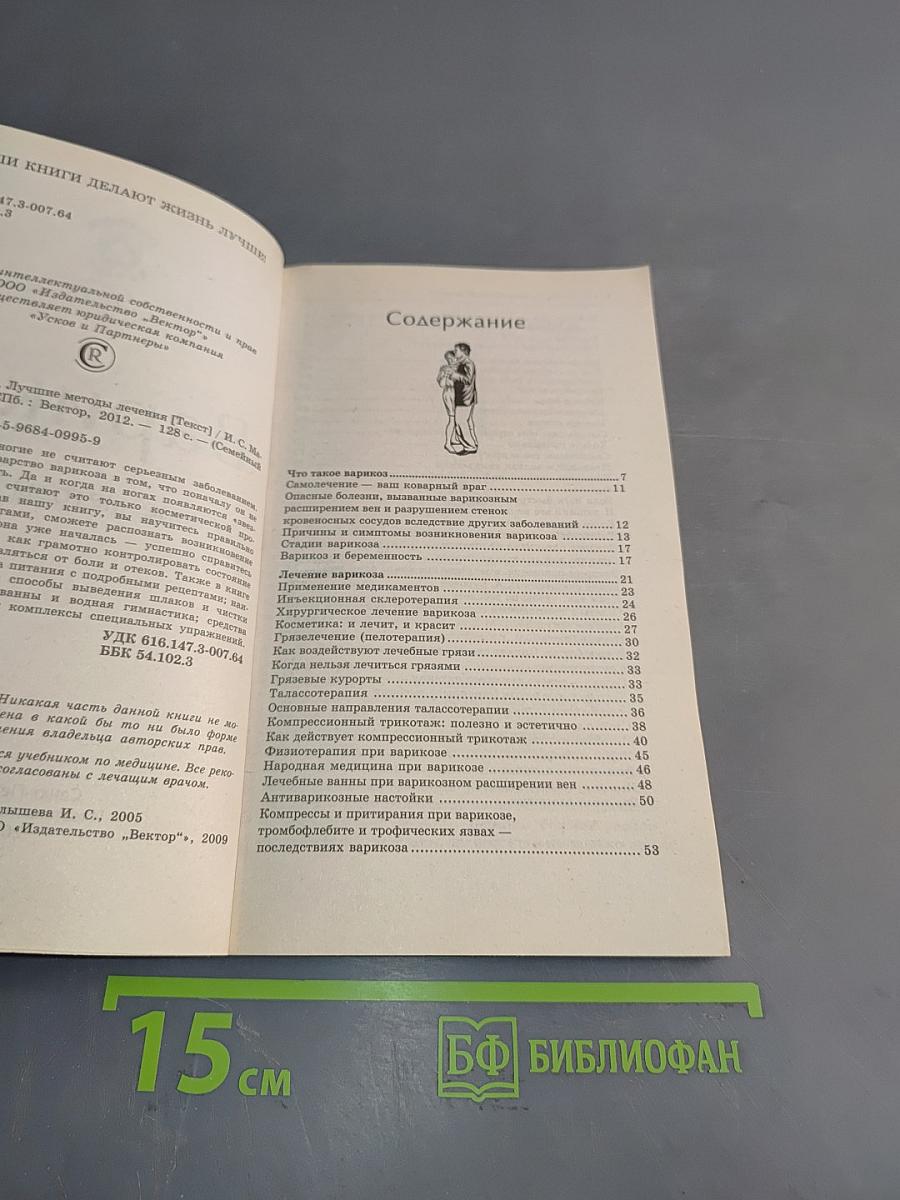 Варикоз. Лучшие методы лечения