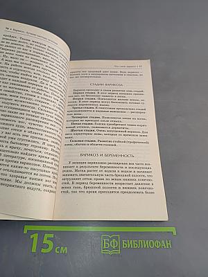 Варикоз. Лучшие методы лечения