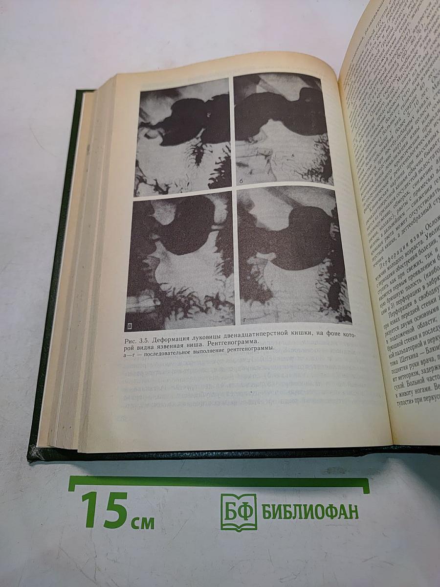 Внутренние болезни