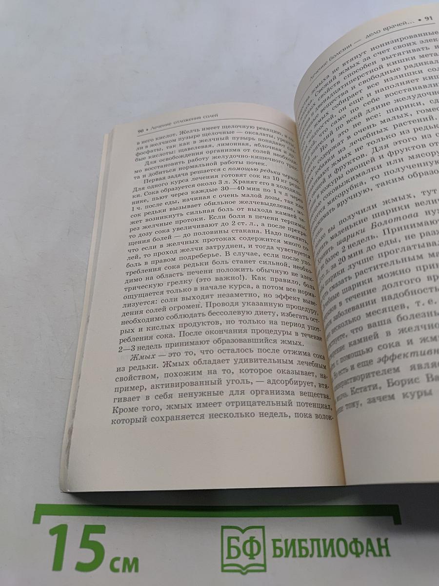 Отложение солей. Лучшие методы лечения
