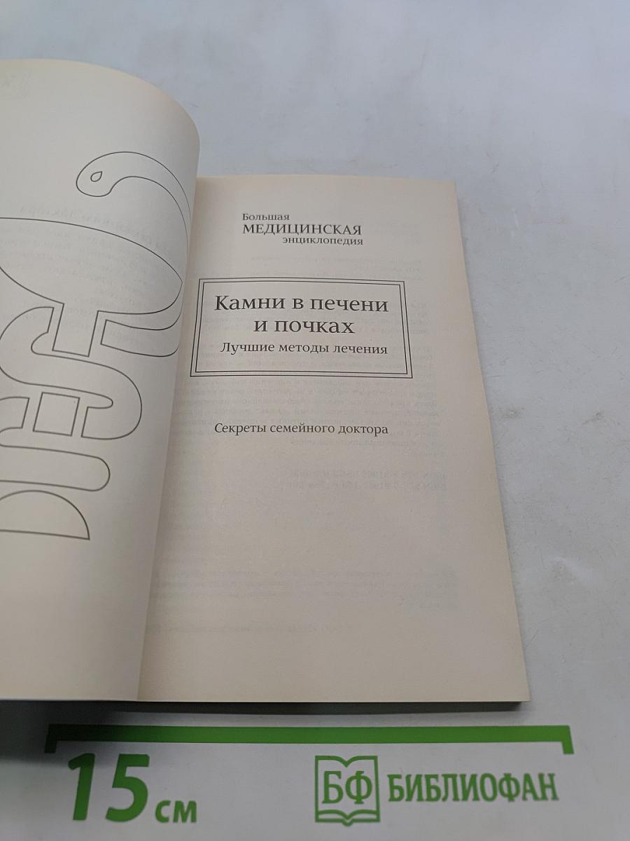 Камни в печени и почках. Лучшие методы лечения