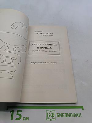 Камни в печени и почках. Лучшие методы лечения