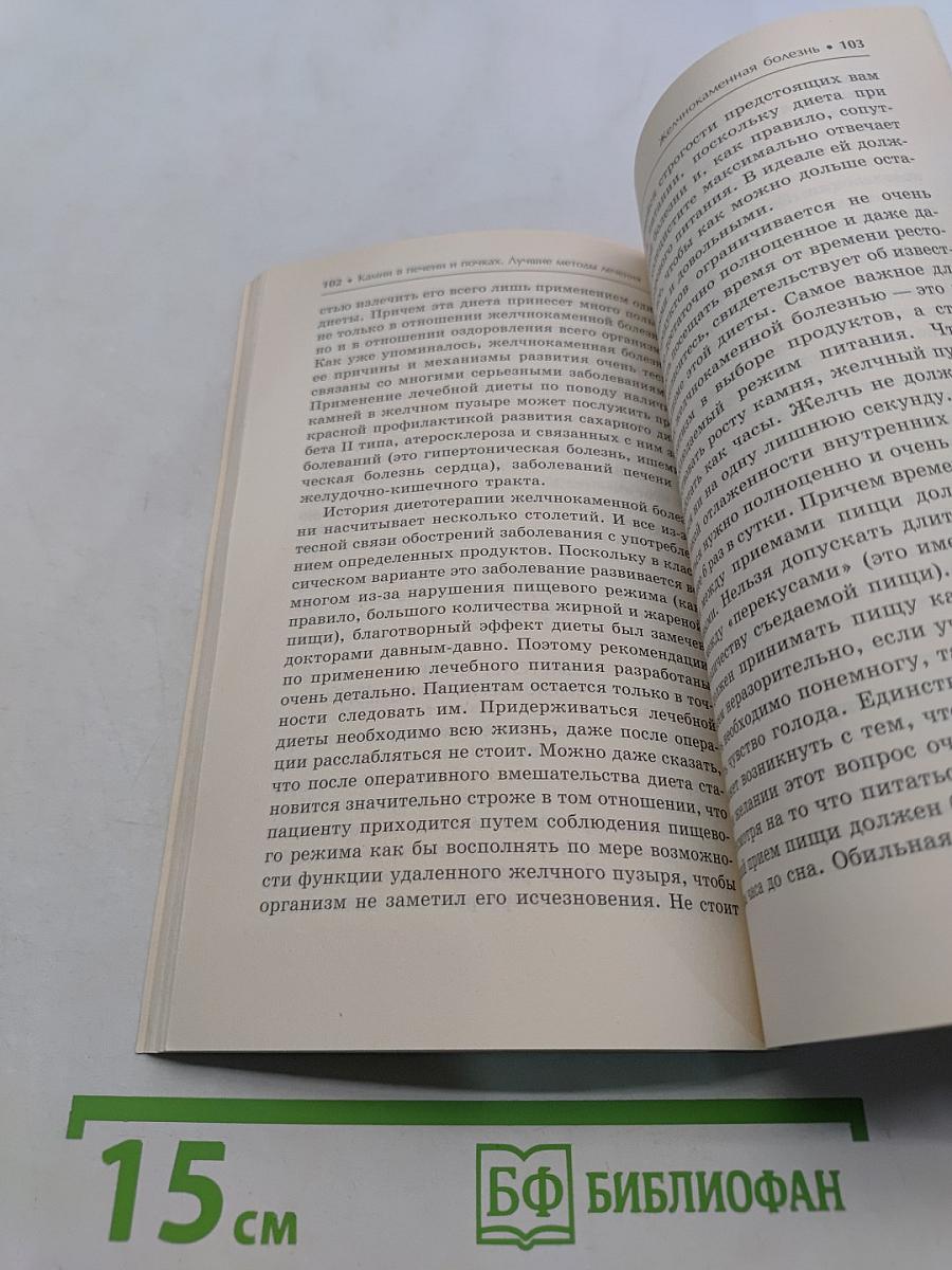 Камни в печени и почках. Лучшие методы лечения