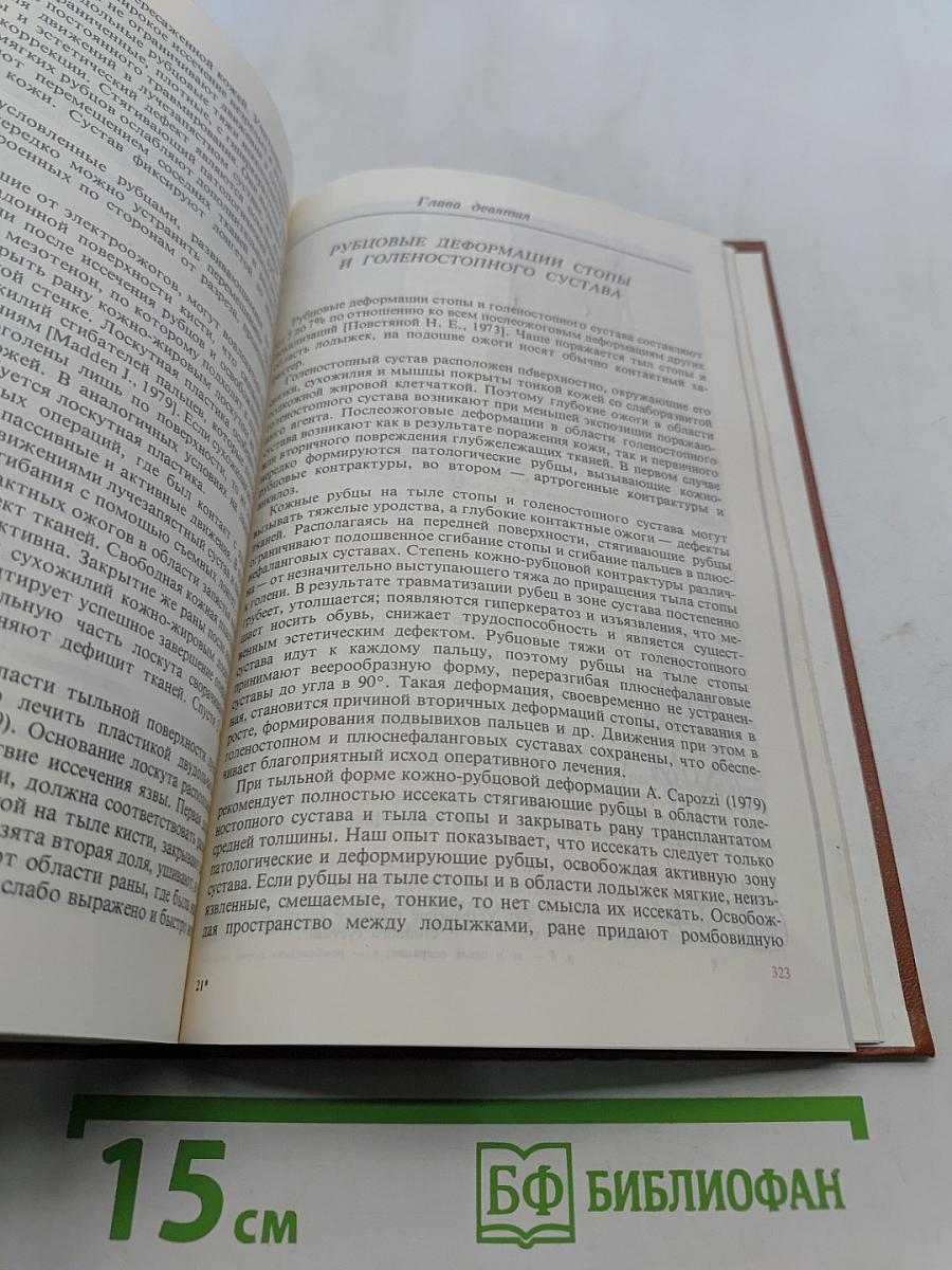 Руководство по реабилитации обожженных