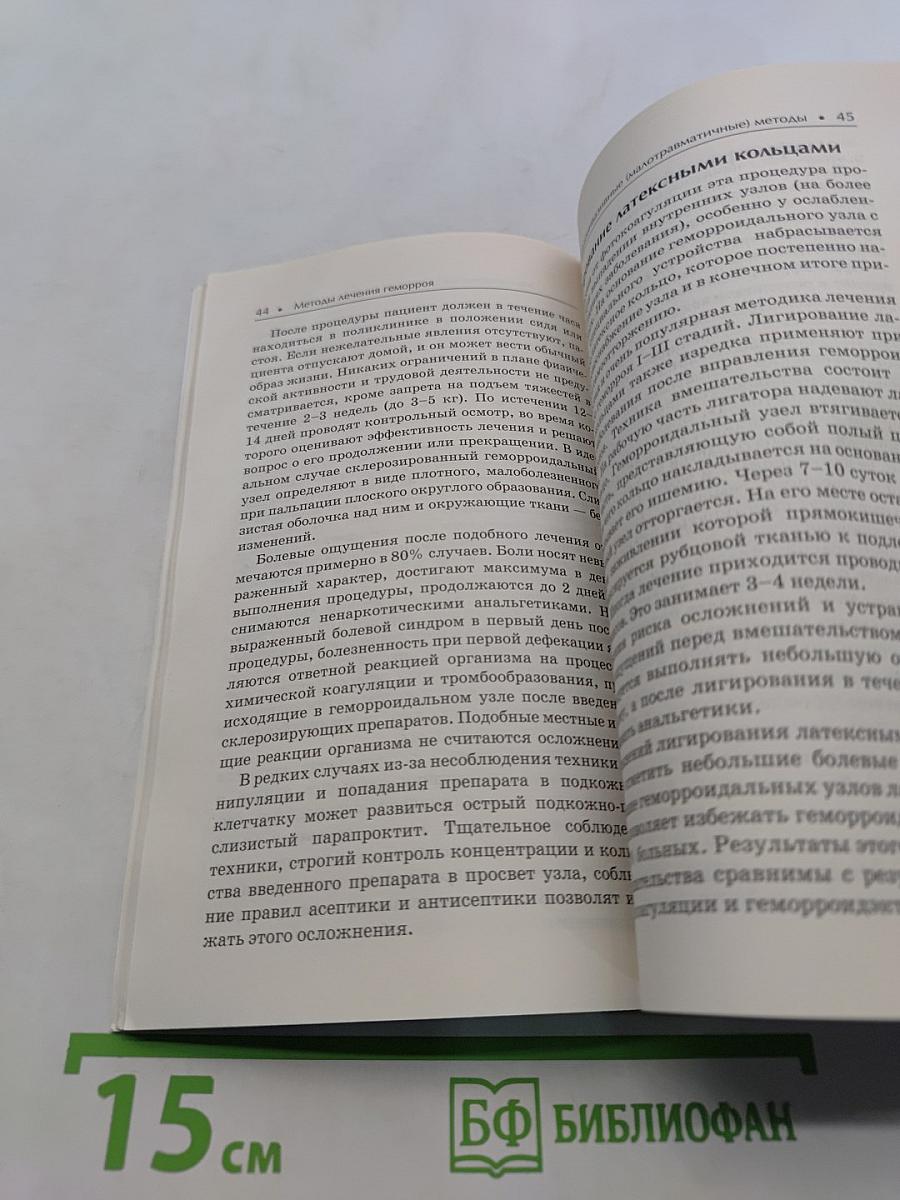 Геморрой. Лучшие методы лечения и профилактики