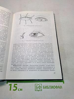 Травмы глаза