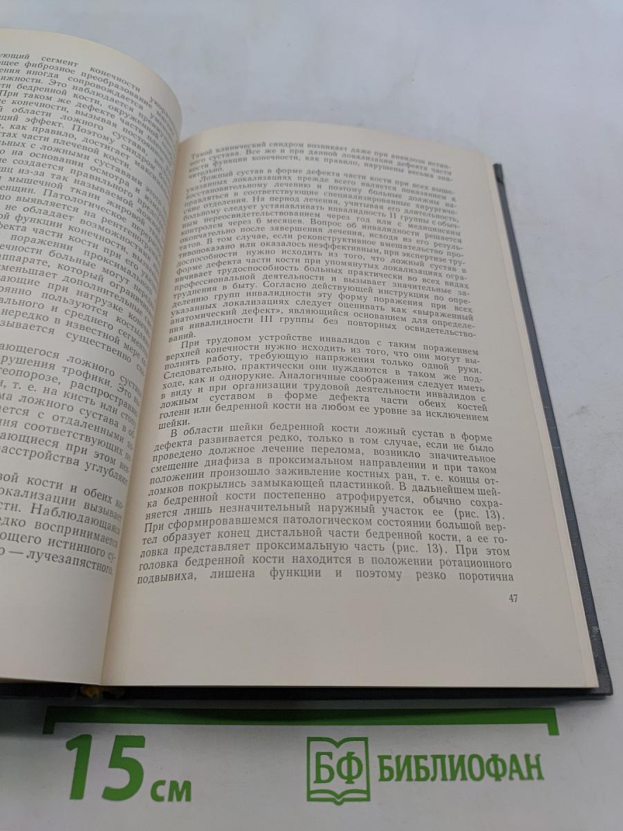 Травматические повреждения костно-суставного аппарата конечностей как причина инвалидности