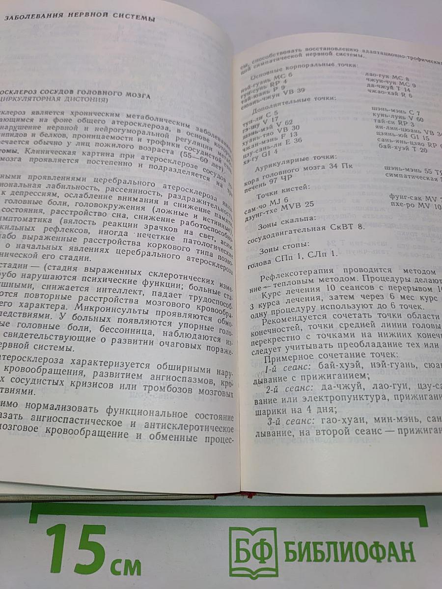 Частная рефлексотерапия. Справочник