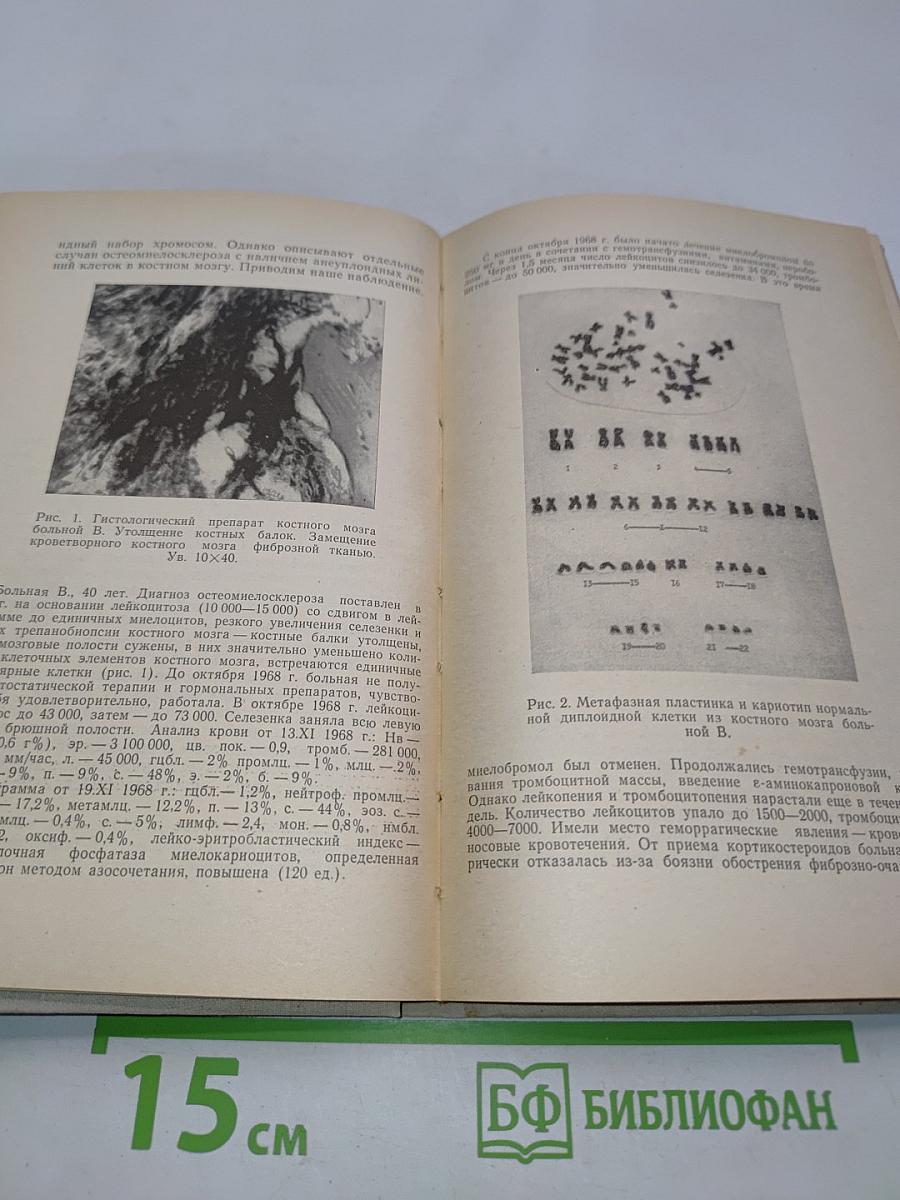 Редкие гематологические синдромы. Выпуск 1