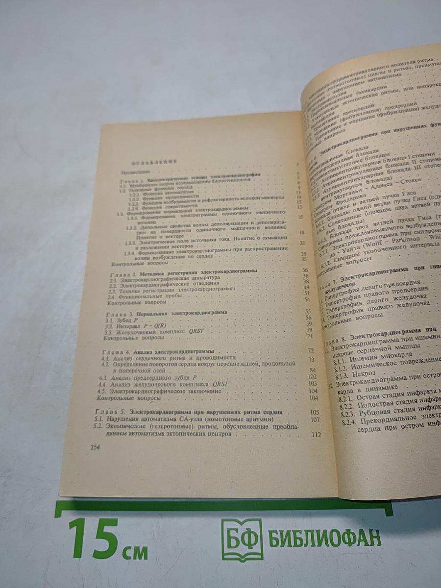 Электрокардиография