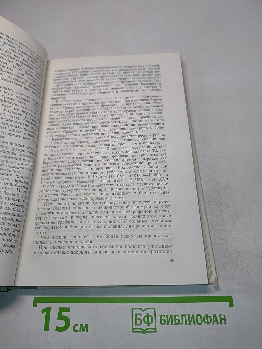 Туберкулез