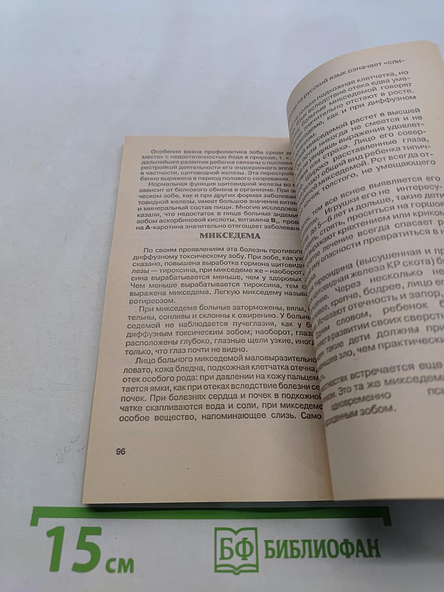 Все о золотом усе из первых рук