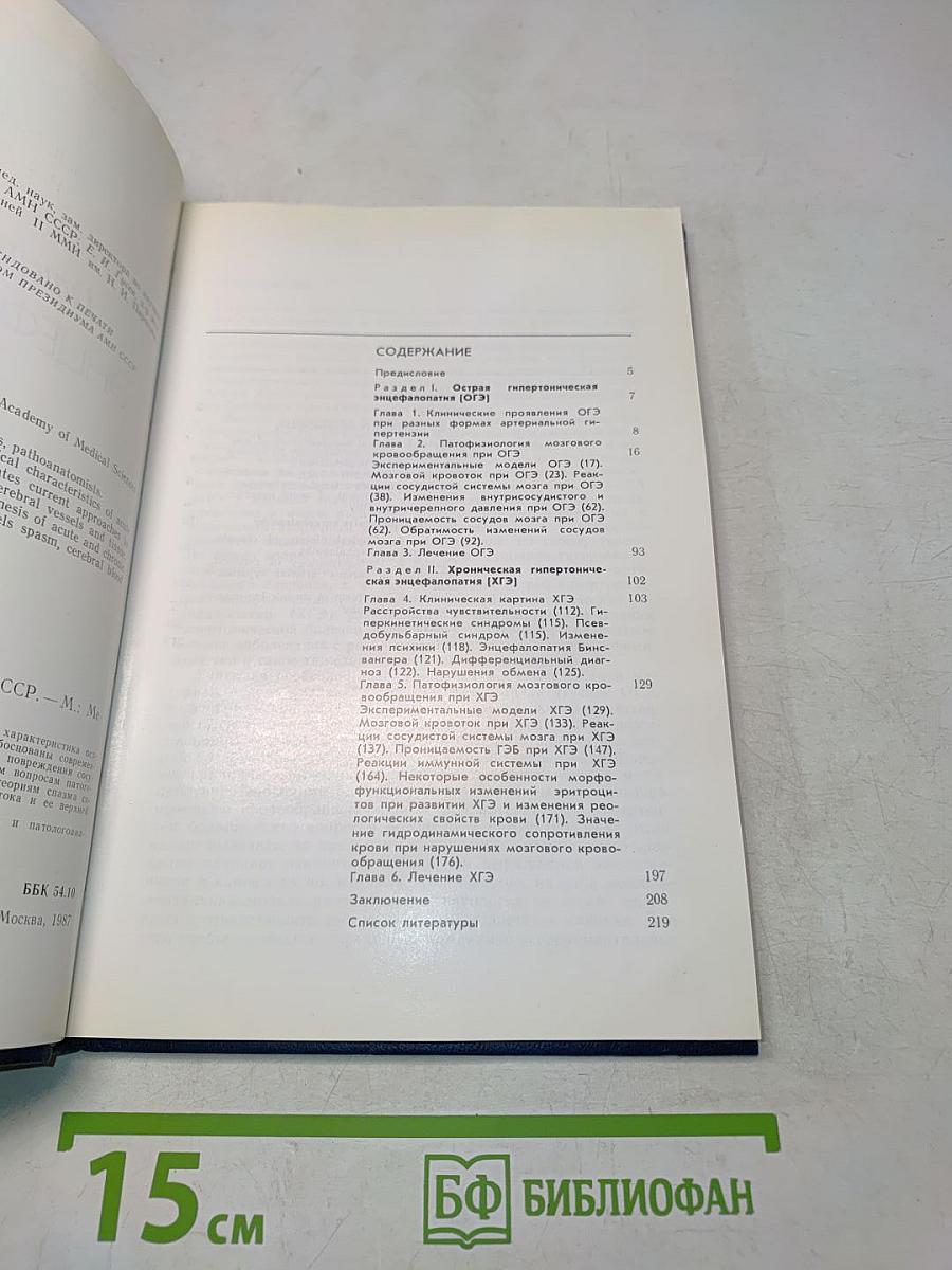 Гипертоническая энцефалопатия