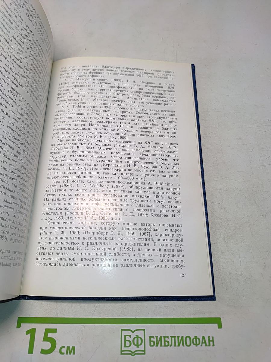 Гипертоническая энцефалопатия